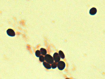 glabrata neg, C.