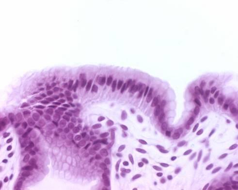 Tutki rauhasputken suhdetta muscularis mucosaan ja lamina propriaan (mitä soluja erotat lamina propriassa?). Tunnista soluista ensimmäiseksi: pintasolut (surface lining cells - mitkä ominaisuudet?