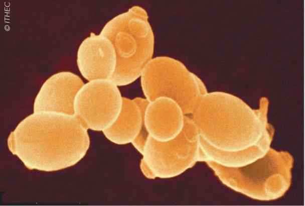 Hiivauute aktivoi pieneliöstön toimintaa Saccharomyces cerevisiae- hiivasta valmistettu uute sisältää runsaasti aminohappoja ja vitamiineja Toimii ravintona hyödylliselle pieneliöstölle ja siten