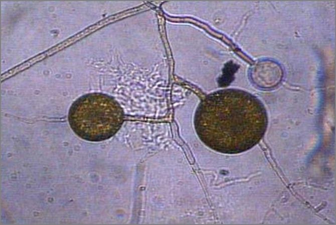 MYC800-mykoritsa : Mykoritsa eli sienijuuri muodostaa pitkäaikaisen hyödyllisen symbioosin isäntäkasvin kanssa MYC800-valmiste sisältää Glomus intraradices-endomykoritsan itiöitä Mykoritsa laajentaa