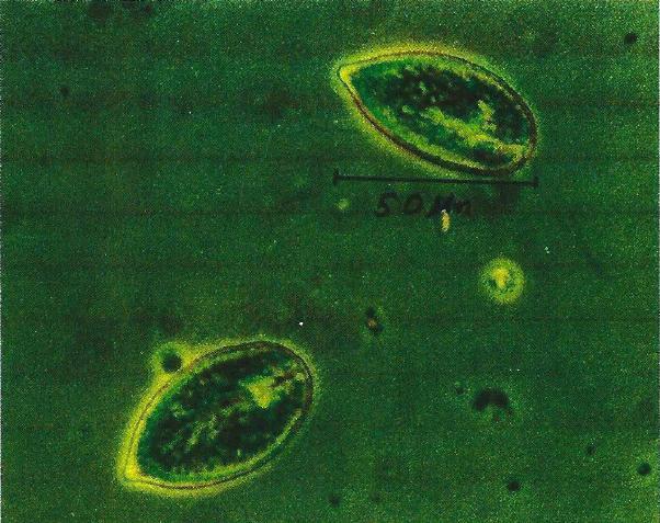 Limalevä Gonyostomum semen viihtyy ravinteikkaissa vesissä