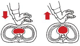 LIITE 1 5. Sulje toisella kädellä sieraimet ja pidä toisella kädellä potilaan leukaa ylhäällä. Puhalla kaksi kertaa ilmaa potilaan keuhkoihin. Muista oikeat otteet ja huulten tiiveys.