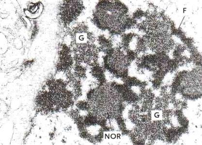ribosomin osaset sisältävät paljon RNA:ta joten nukleolus värjäytyy voimakkaasti hematoksyliinilla - erityisen hyvin iso nukleolus erottuu kun sen ympärillä on runsaasti eukromatiinia