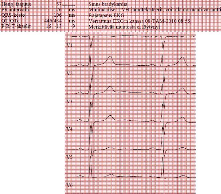 Ekg LVH diagnostiikassa (1)