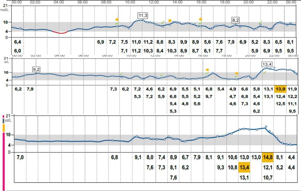 Libre 2/2017, Toujeo 12 yks, Novorapidia laittaa 45 60min ennen