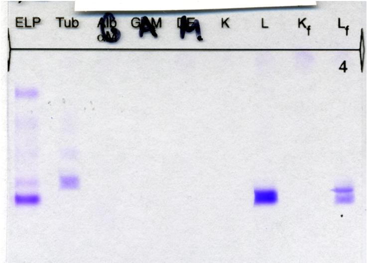 Virtsan proteiinielektroforeesi ja immunofiksaatio