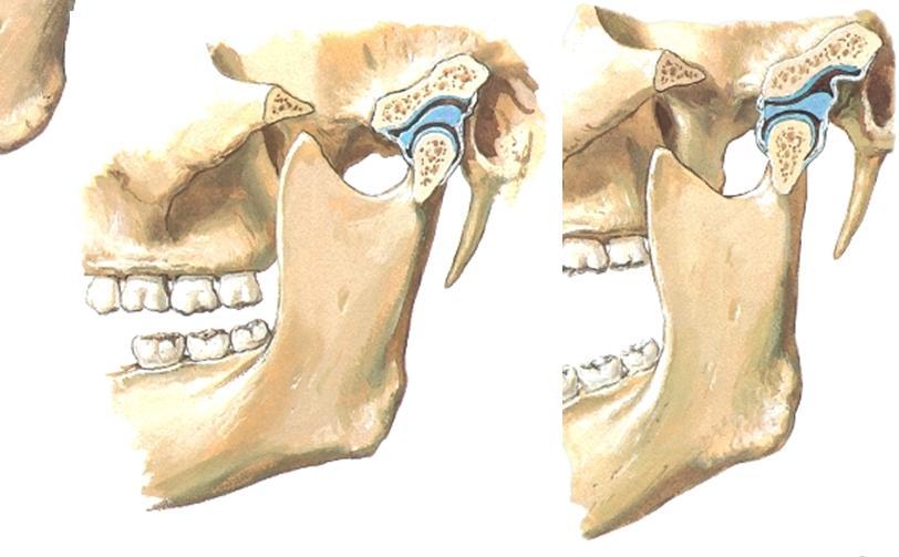 Suu apposen auki Articulatio discotemporale on liukunivel - Yksittäisessä nivelessä voidaan nähdä saranaliike (gångjärnsrörelse) ja liukuliike (glidrörelse) kun suuta avataan/suljetaan.