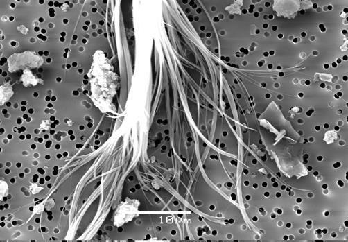 a) b) Kuvat 3 a ja b. Erilaisia pölyjä elektronimikroskoopilla kuvattuna. Kuvissa esitetty asbestia (a) ja siitepöly (b). Mittajana joko 10 µm (a) tai 5 µm (b). Kuvat: J. Säntti. Kuva 4.