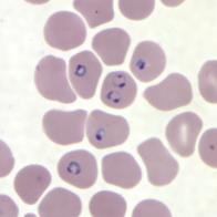 Plasmodium falciparum
