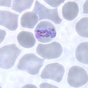 Plasmodium