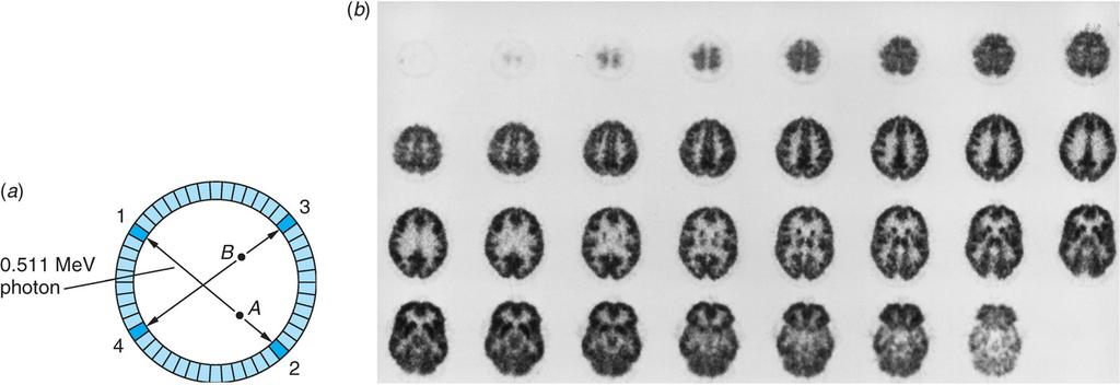 Tavallisimmin CT tarkoittaa perinteisestä röntgenkuvauksesta kehitettyä menetelmää, kuva 11-64.