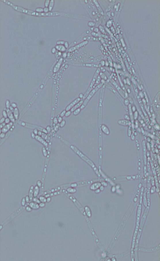 Candida krusei resistentti flukonatsolille pesäke kermanvärinen, mattapintainen, laakea (Sabouraud) CHROMagar Candida: vaaleanpunainen