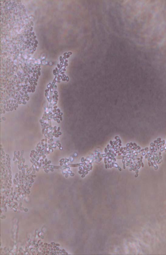 Candida guilliermondii voi olla resistentti atsoleille sekä kaspofungiinille