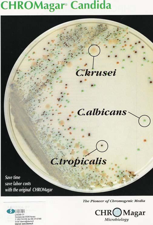 CHROMagar Candida resistenttien hiivojen nopea tunnistus sekä löytyminen sekaviljelmistä ensimm.