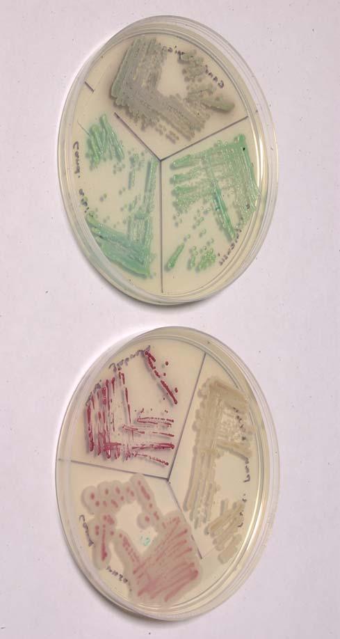 CHROMagar Candida kokeilussa syksyllä 2004 myös muita kromogeenisia agareita: BioMérieux /