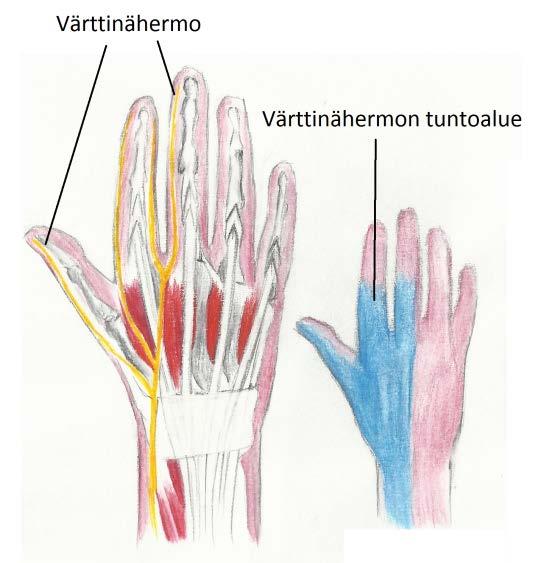 Kuvio 5. Värttinähermon tuntoalue Värttinähermon halvannuttua käden ojentaminen (ekstensio) ranteesta ei onnistu. Osalla potilaista tunto on alentunut kämmenselässä.