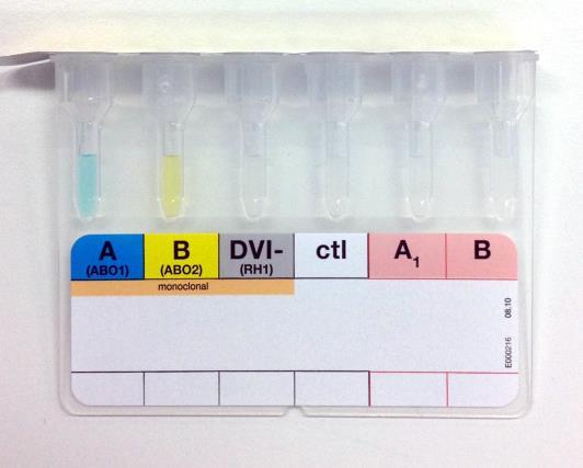 19 Kuvio 7. Kuvassa Bio-Rad:n ABO/D+reverse grouping kortti. Ensimmäinen kuva käyttämättömästä geelikortista ja toinen kuva määritetystä verinäytteestä.