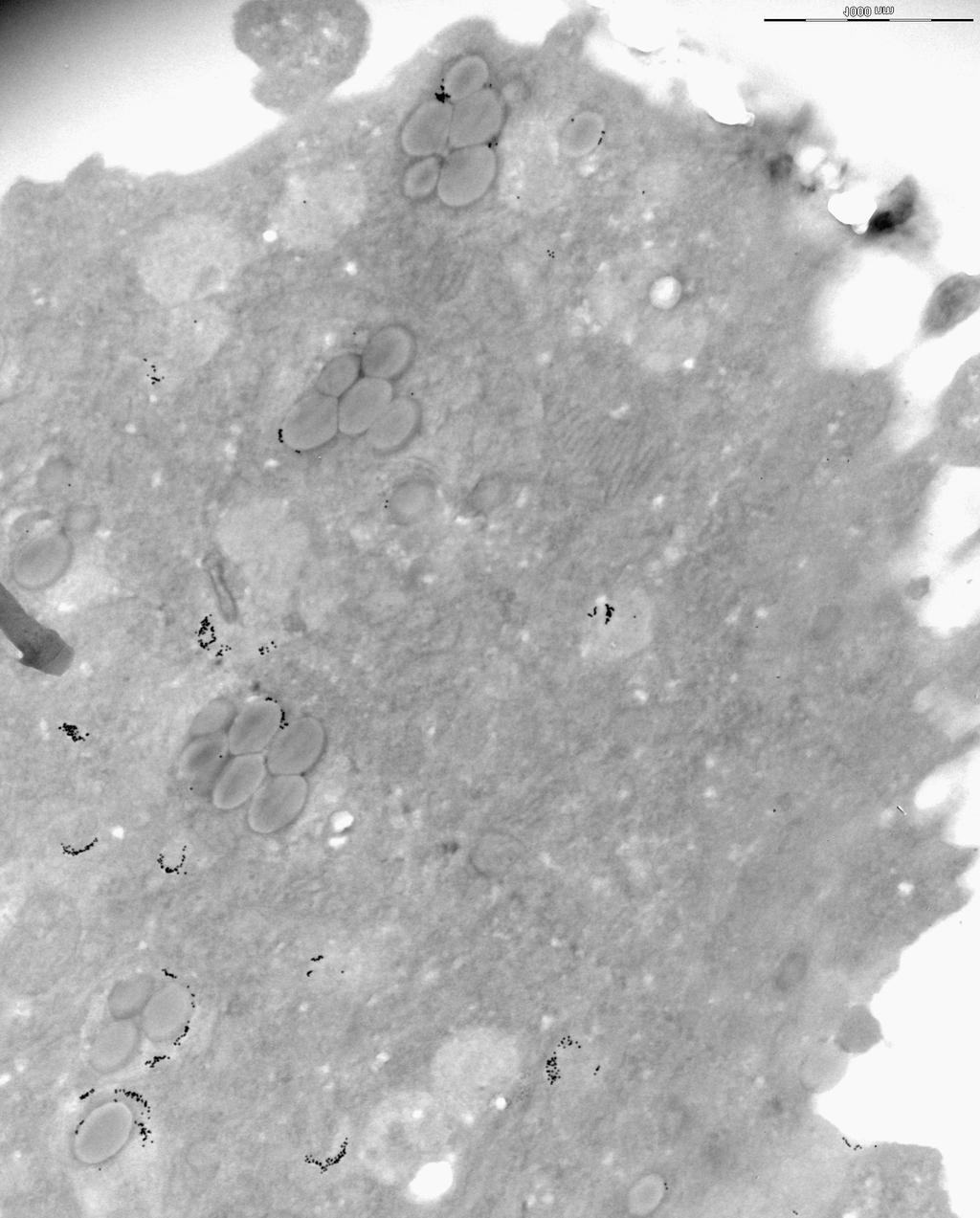 Elektronimikroskopian avulla pystyttiin myös tutkimaan, ovatko