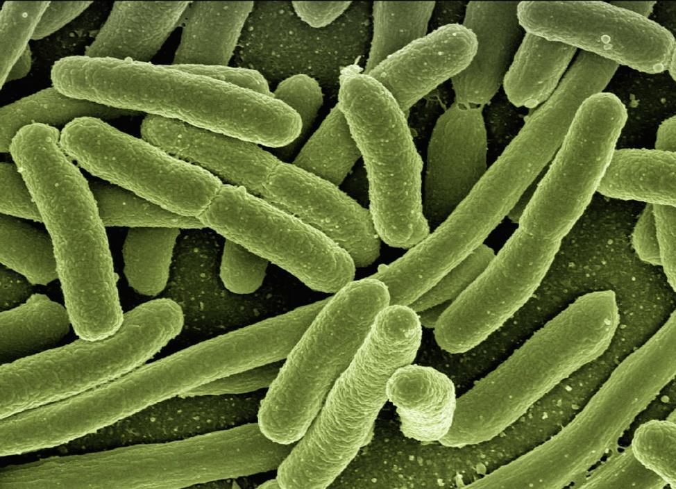10 Kolibakteeri eli Escherichia coli (E. coli) (Kuva 1) muodostaa suurimman osan ihmisen suoliston normaalifloorasta (normaali bakteeristo).