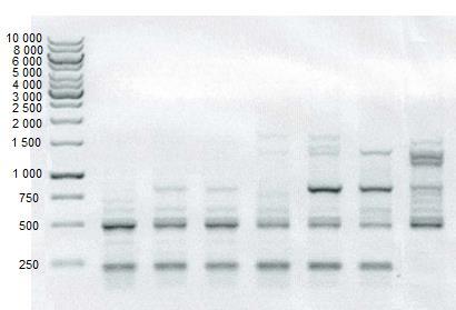 25 1 2 3 4 5 6 7 Kuva 6. Pcc-kannat geelissä acna-geenin PCR:n jälkeen. Kannat 1-7 numerojärjestyksessä: s0416 s0417, s0421, s0427, t0437, t0438 ja SCC3193.