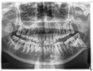 5 Käyttö Sirona Dental Systems GmbH 5.4 Panoramakuvaus 5.4.1.