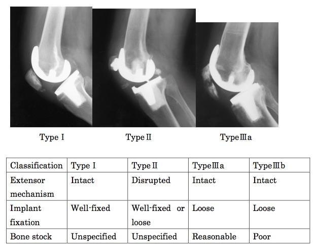 Patella: