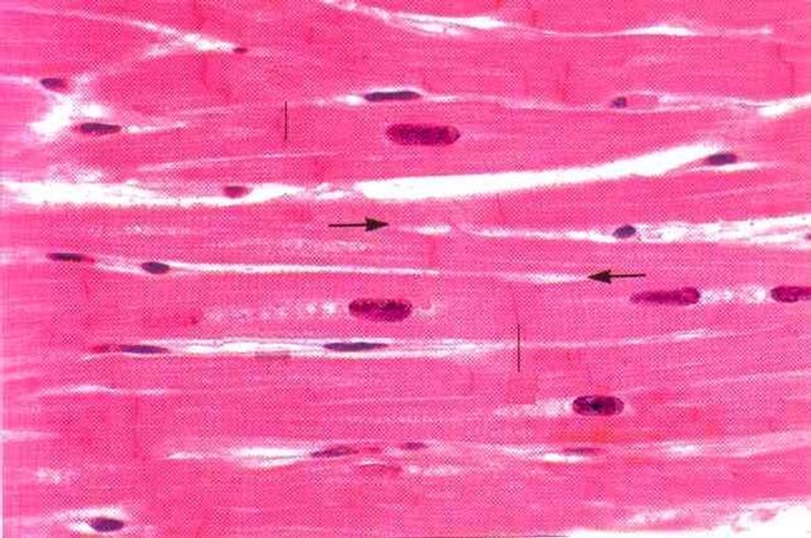 Vertaa submukosassa olevien fibroblastien tumiin - onko eroa? - Pitkittäisessä lihaskerroksessa näet sileälihassolujen poikkileikkauksia.