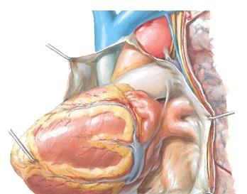 Nyt voit tutkia sydämen liikkuvuutta sydänpussin sisällä heiluttelemalla sen kärkeä eri suuntiin. Huomaa sydämen pintaa peittävä ohut, kiiltävä epikardium (lamina visceralis pericardii).