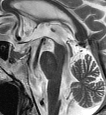 DIAGNOSTIIKKA Parkinsonismisairauksien