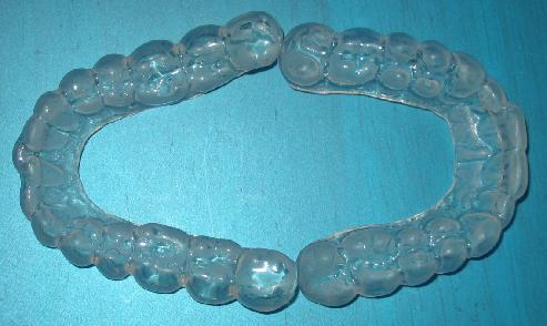 vähintään 5min Lopuksi suun huuhtelu vedellä CHX-geeli Geelipuhdistus kotona Kuuriluontoisesti: 1-2 x/vrk 1-2 viikon ajan Hampaat harjataan hammastahnan sijasta geelillä Kotona suoritettavaa