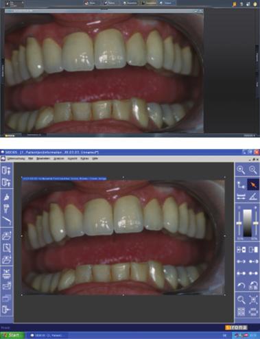 Purge Clean A/B I-Videon käyttö kameran ollessa telineessä Kun kamera on telineessä, I-Video-sovellusta ohjataan EasyPad-käyttöliittymän kolmella toimintonäppäimellä tai EasyTouchkosketusnäytön