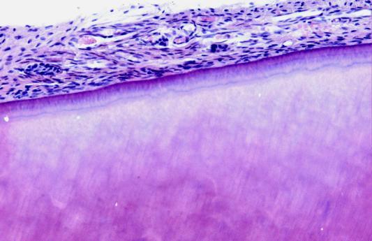Sementoblastit ja sementosyytit Erilaistuvat hammasfollikkelin (kehittyvää hammasta ympäröivä sidekudospussi) soluista Hertwigin epiteliaalisen juuritupen solujen indusoimina Sementoblastit