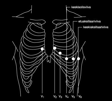 11 Rintakytkennät (kuvio 7) puolestaan sijaitsevat lähempänä sydäntä ja antavat edellisiä yksityiskohtaisemman kuvan sydämen sähköisestä aktivaatiosta varsinkin sydämen vasemman kammion osalta.