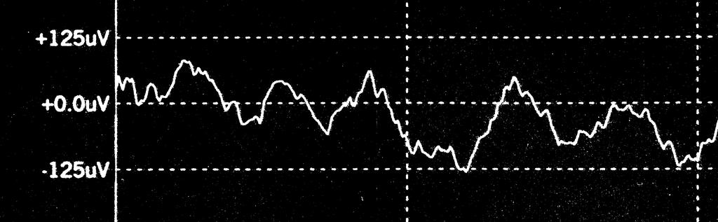 EEG & EMG