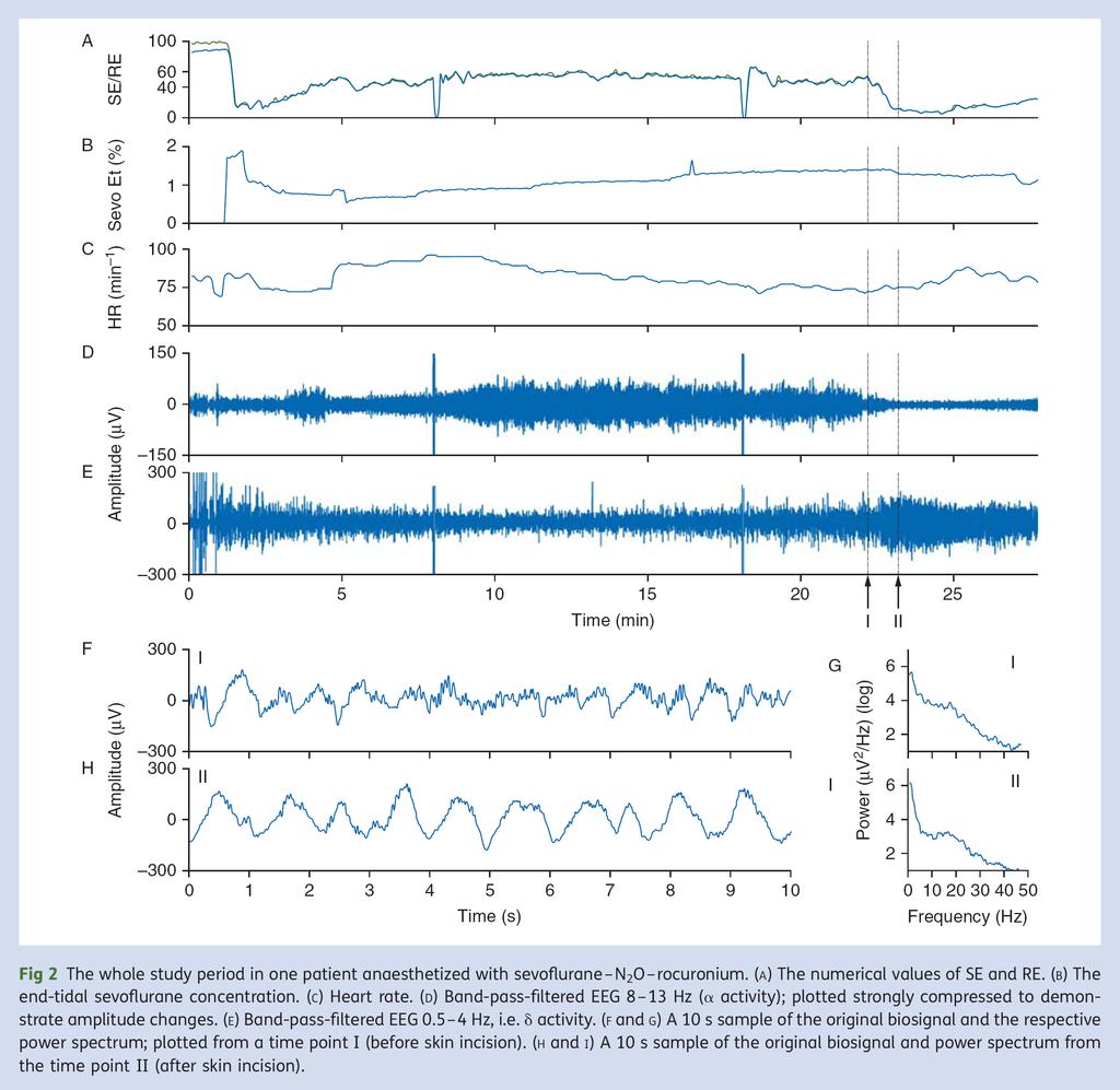 EEG delta arousal