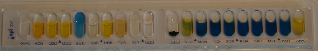 Näyte 2/2013. Pseudomonas oryzihabitans 1.