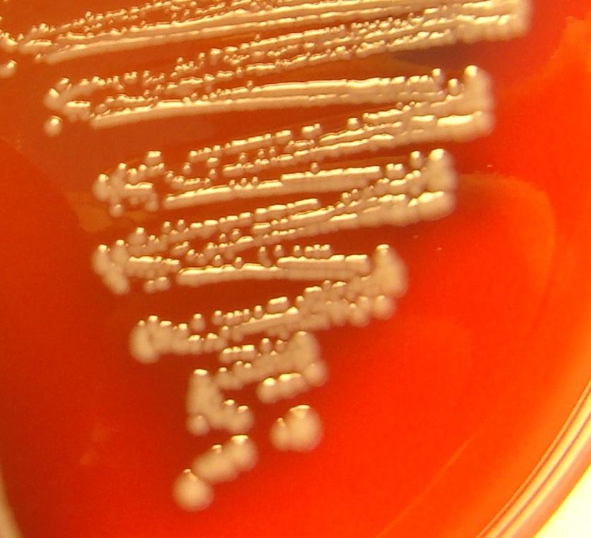 Näyte 3/2013 Enterobacter