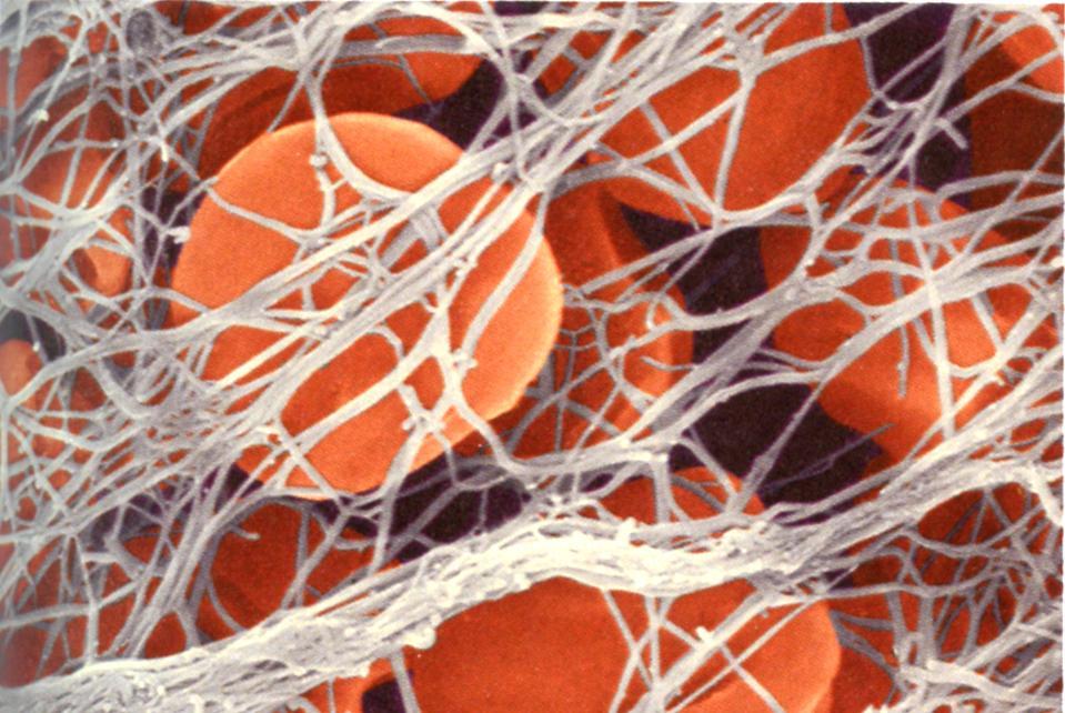 A Text and Atlas Key points - blood Plasma + cellular elements: erythrocytes, leukocytes, and