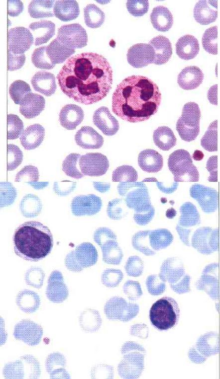 vastaan ja auttavat kudosvaurion siivoamisessa Plasma on proteiinipitoinen liuos. Plasma sisältää mm.