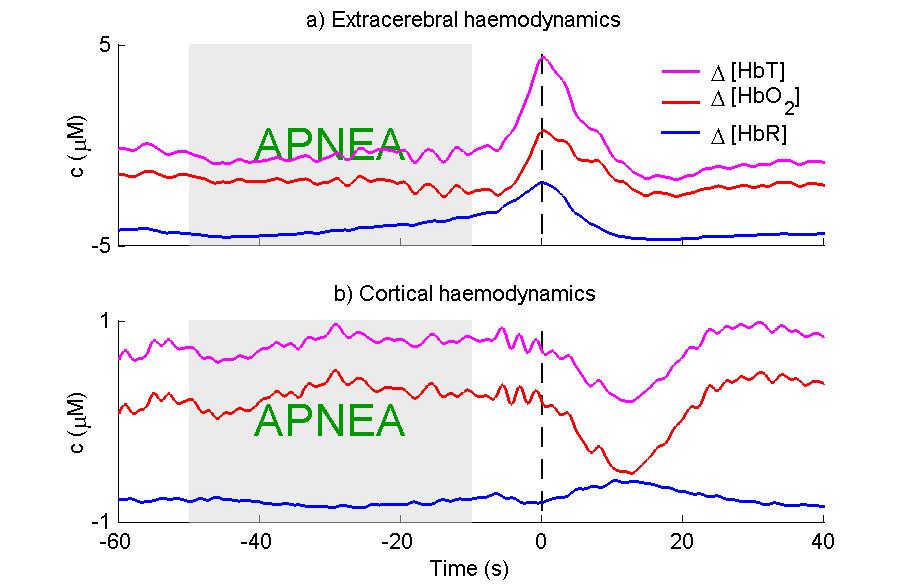 NIRS uniapnean monitoroinnissa
