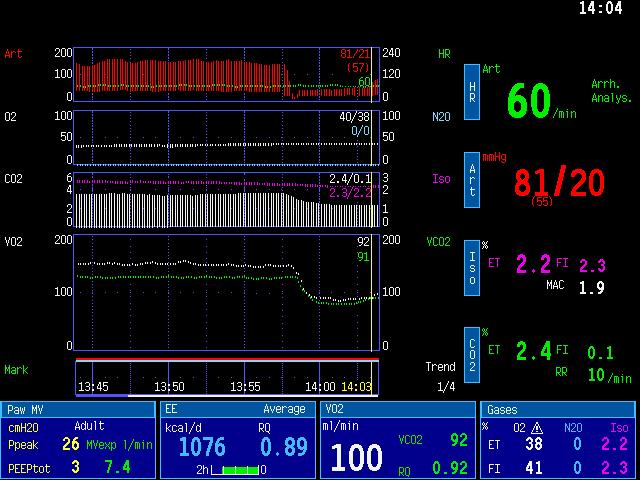 Typical display field
