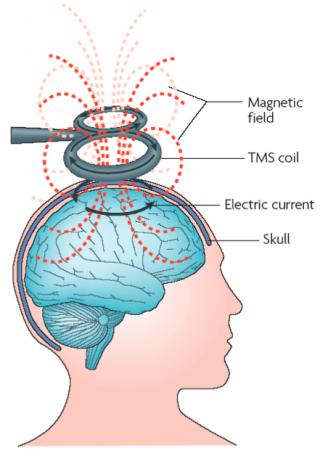 Ihmisaivojen kuvantaminen Magneettienkefalografia (MEG) Myös EEG (elektroenkefalografia)