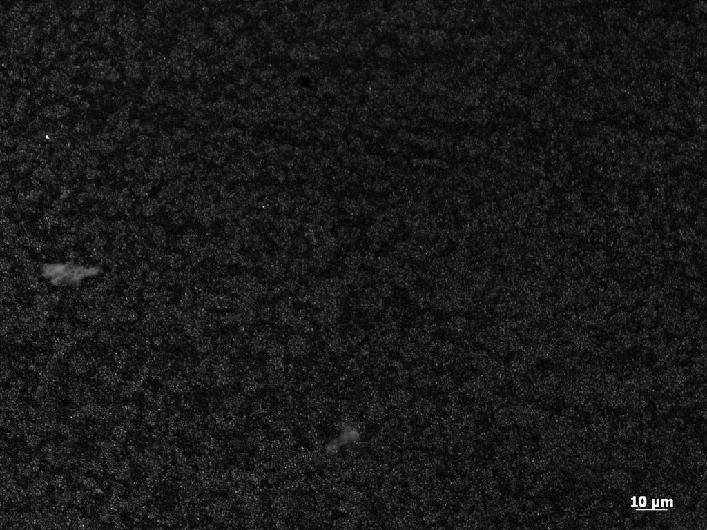 32 8 TULOKSET 8.1 Fibronektiinitestaus Fibronektiinin pitoisuuden testauksesta otettiin fluoresenssimikroskoopilla valokuvia. Kuvat otettiin fibronektiinin eri pitoisuuksista sekä BSA-geelistä.