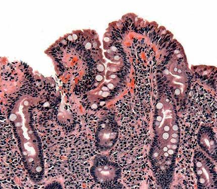 Proteiinien verkko Kemiallisesti gluteeni on useiden proteiinien yhdistelmä.