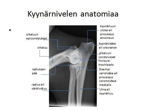 Kyynärnivelen anatomiaa: Kyynärnivel on monimutkainen nivel ja tyypillinen sarananivel, jossa liikkeet rajoittuvat ojennukseen ja koukistukseen.