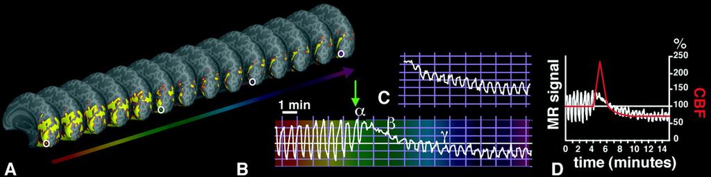 Time-dependent BOLD activity changes from a single region of interest in VI, acquired before and during episodes of either