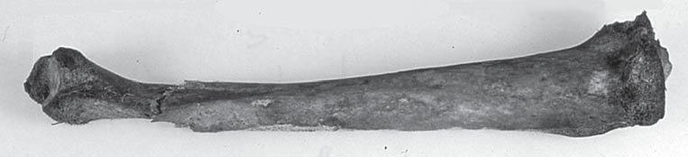 Beheaded man from Hailuoto Fig, 4. The right tibia from the individual of grave 203. Observe that the epiphyses are fully fused.