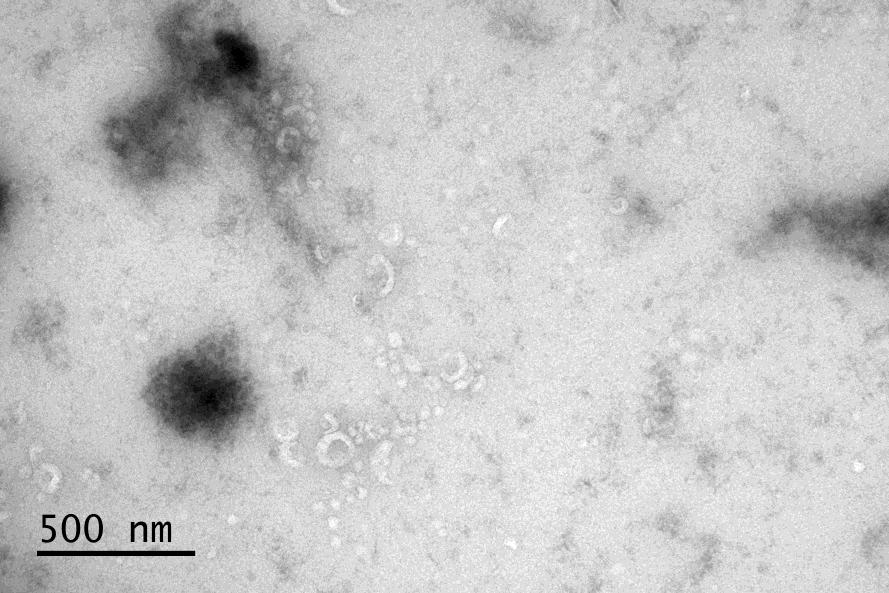6 Kuva 6. PNT2-solujen erittämiä eksosomeja. Elektronimikroskooppikuva Mari Palviainen. Eksosomit syntyvät monivesikkelisten kappaleiden (engl.
