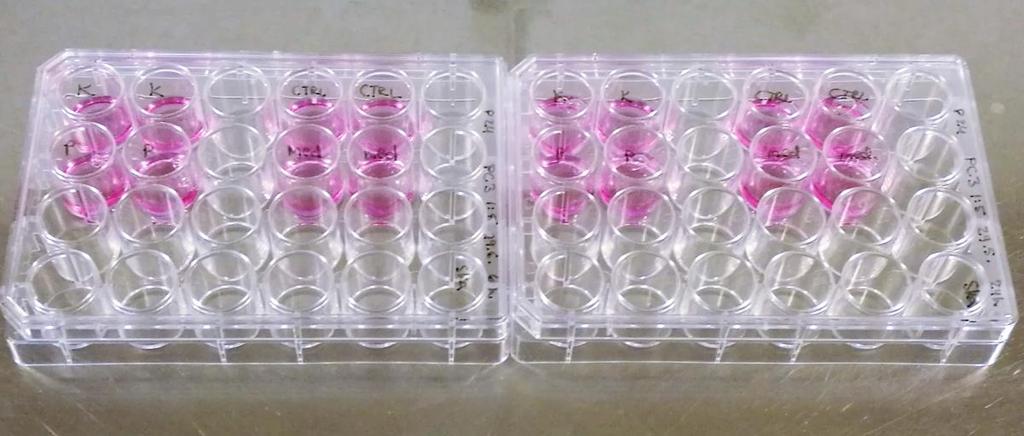 20 (suodatettu 0,22 µm suodattimella), josta pipetoitiin leimattaviin näytteisiin 0,5 µl väriä.