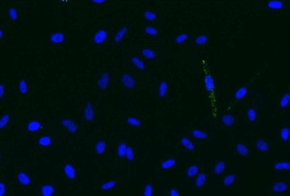 29 Kuva 25. Esimerkkikuva lyofilisoitujen verihiutale-ev:den sisäänotosta PC3-soluihin. Fluoresenssimikroskooppikuva Saara Kauremaa.